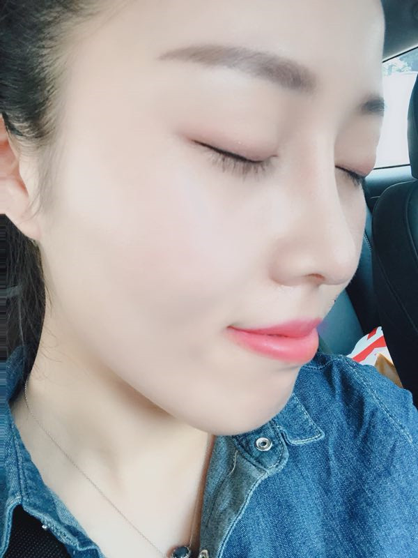 潍坊华美任传琦肋软骨隆鼻
