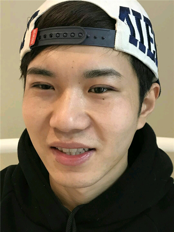 天津知妍薛云鹏割双眼皮