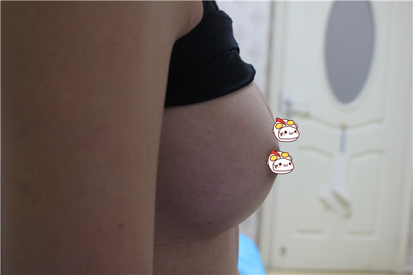又来更新啦!隆胸案例图走一波~~,微重口,武汉诚嘉真爱龚卫华假体隆胸