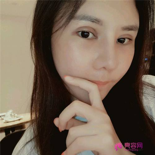 北京沃尔刘彦军肋软骨隆鼻