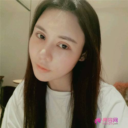 北京沃尔刘彦军肋软骨隆鼻