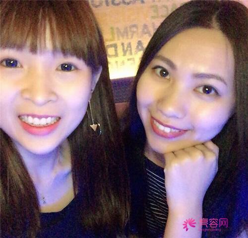北京丽星魏志香双眼皮