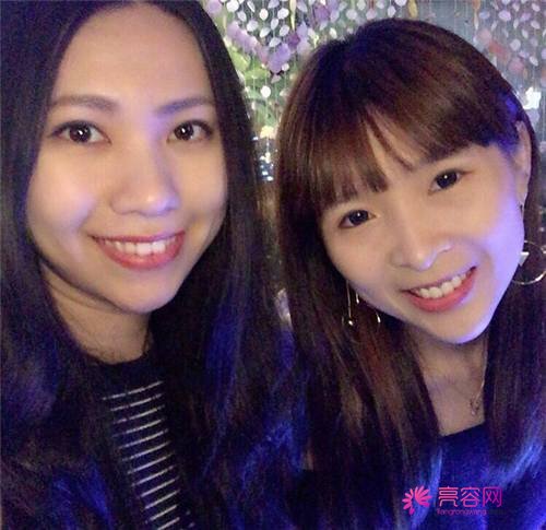 北京丽星魏志香双眼皮