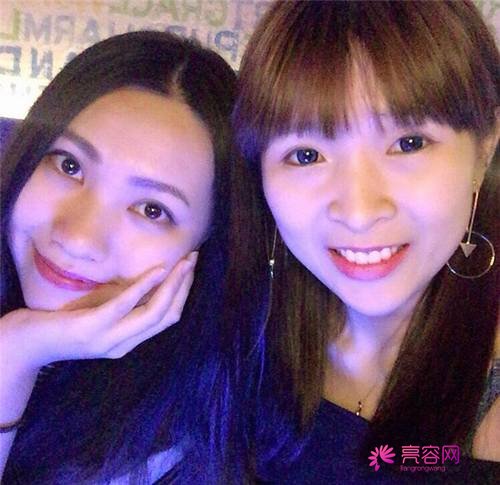 北京丽星魏志香双眼皮