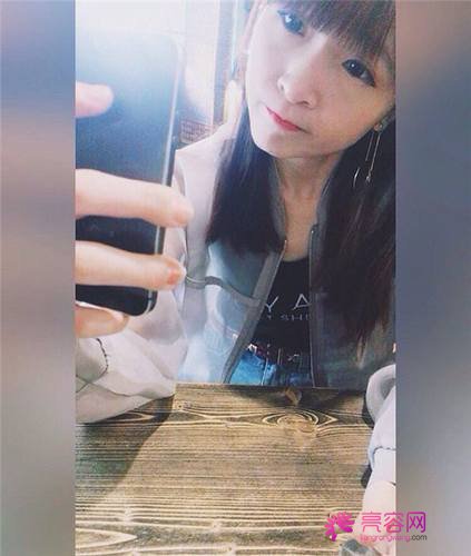 北京丽星魏志香双眼皮