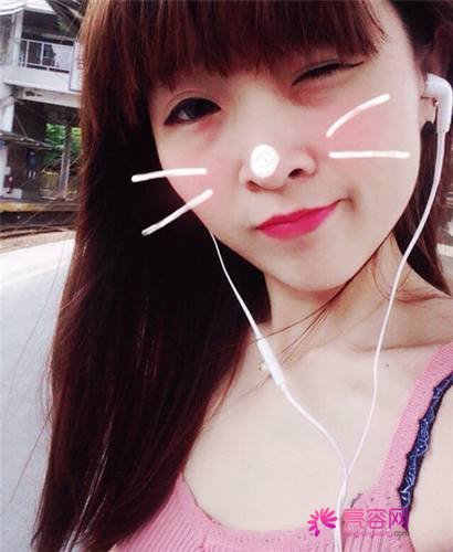 北京丽星魏志香双眼皮