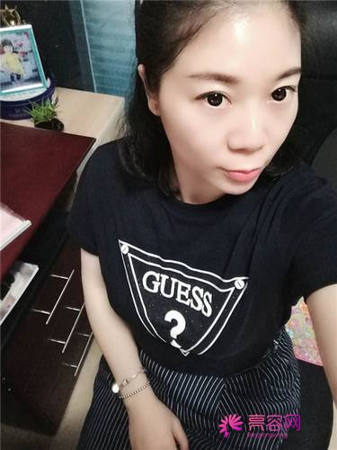 上海薇琳注射瘦脸瘦脸