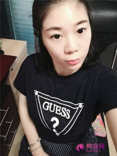 上海薇琳注射瘦脸瘦脸