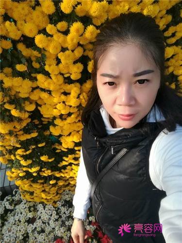 上海薇琳注射瘦脸瘦脸