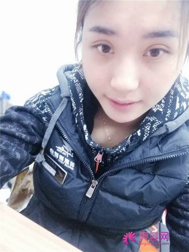 北京炫美徐学东自体脂肪填充