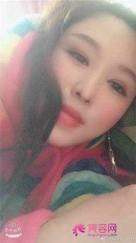 北京来美安王振军双眼皮内眼角