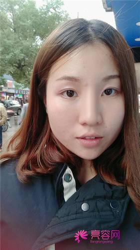 上海喜美王会勇隆鼻