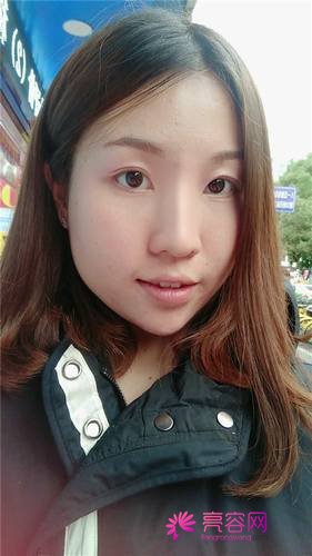 上海喜美王会勇隆鼻