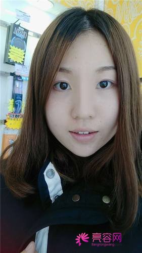 上海喜美王会勇隆鼻
