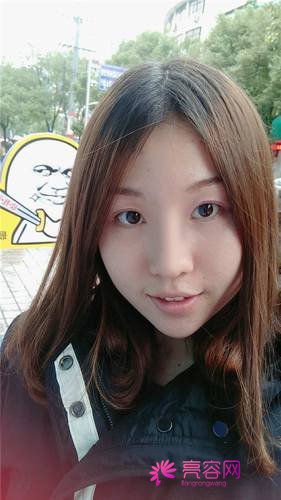 上海喜美王会勇隆鼻