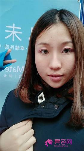 上海喜美王会勇隆鼻
