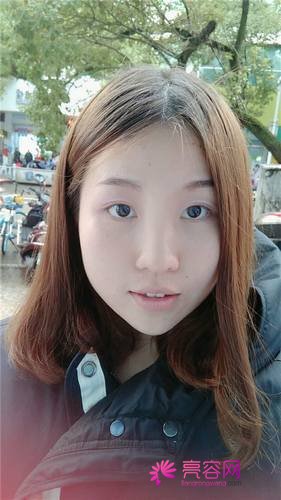 上海喜美王会勇隆鼻