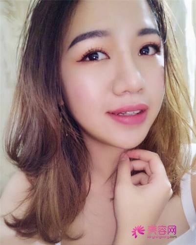 北京柏丽李劲良隆鼻