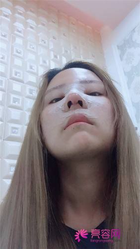 上海天大刘先超隆鼻