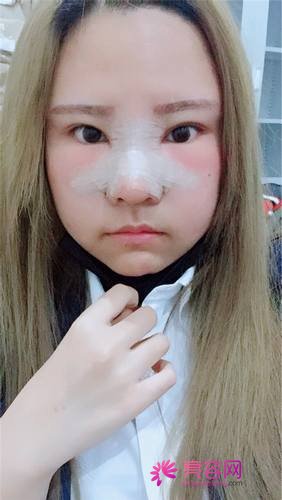 上海天大刘先超隆鼻