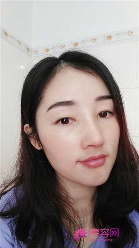 长沙美莱周文亮隆鼻