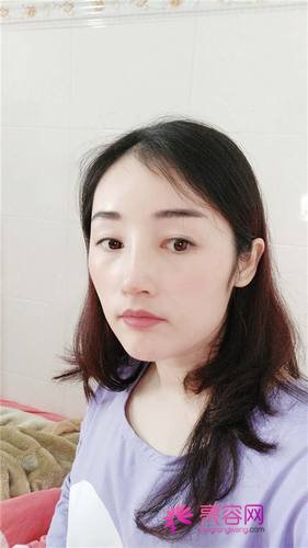 长沙美莱周文亮隆鼻