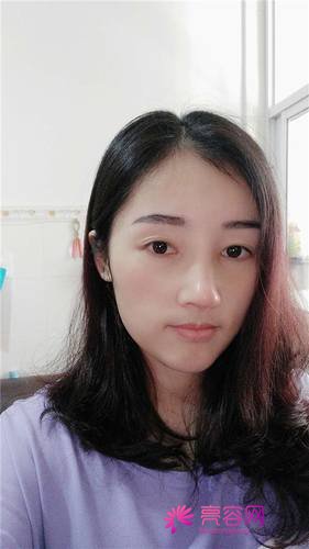 长沙美莱周文亮隆鼻