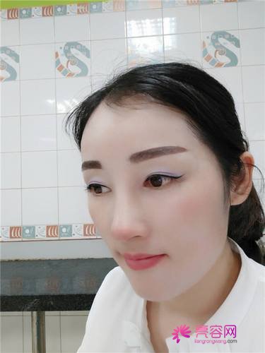 长沙美莱周文亮隆鼻