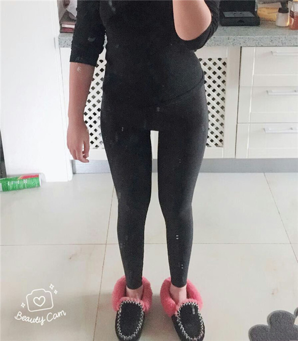 北京玉之光王明利吸脂瘦大腿