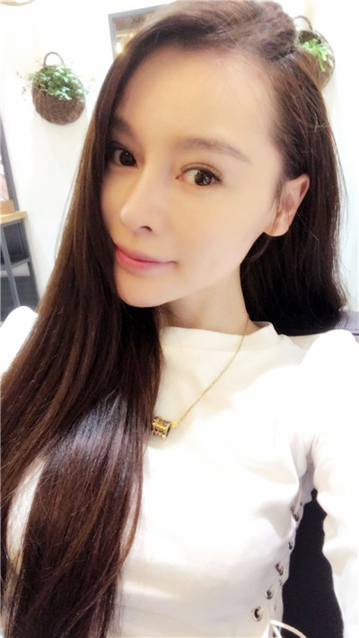 北京沃尔刘彦军医生隆鼻案例
