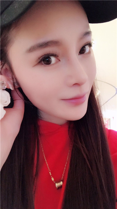 北京沃尔刘彦军医生隆鼻案例