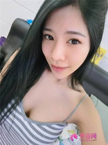 北京艺美王东自体脂肪填充