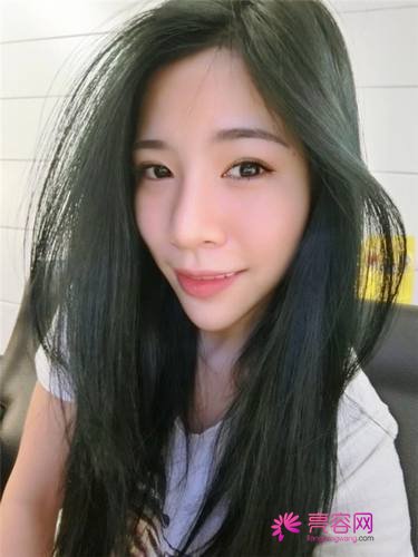 北京艺美王东自体脂肪填充