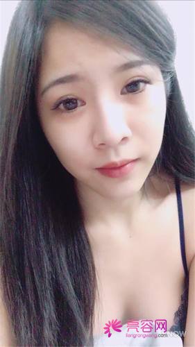 北京艺美王东自体脂肪填充