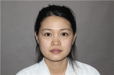 上海九院，陈付国，，案例，价格，