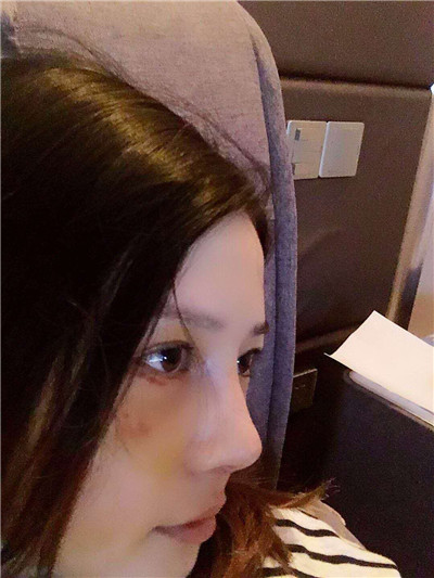 上海九院，陈付国，，案例，价格，