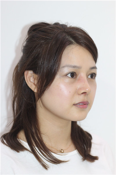 上海九院，陈付国，，案例，价格，