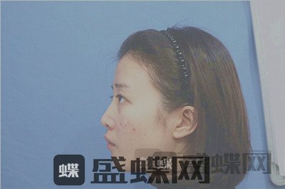 杭州格莱美,张龙,,案例,价格,