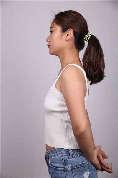 上海华美谢卫国假体隆胸案例价格分享,这么真实自然的胸我是第一次见到!