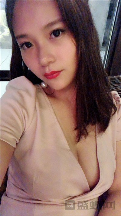 上海华美谢卫国假体隆胸案例价格分享,这么真实自然的胸我是第一次见到!