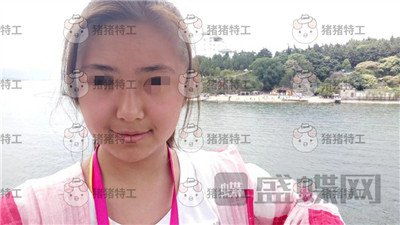 重庆新铜雀台,鹏,隆鼻,案例,价格,