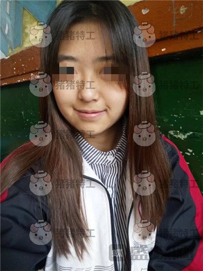 重庆新铜雀台,鹏,隆鼻,案例,价格,