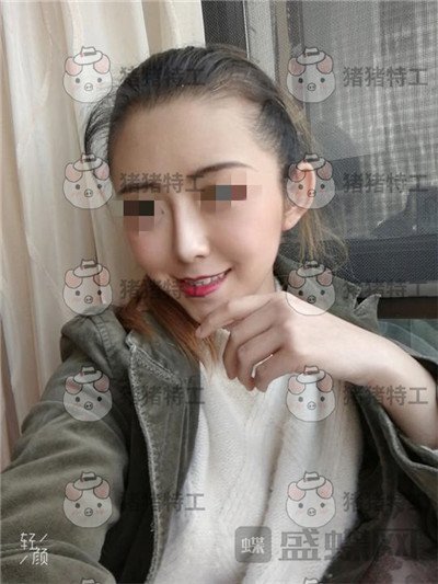 重庆新铜雀台,鹏,隆鼻,案例,价格,