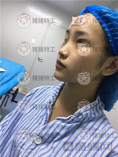 长沙南湖,何怀万,隆鼻,案例,价格,