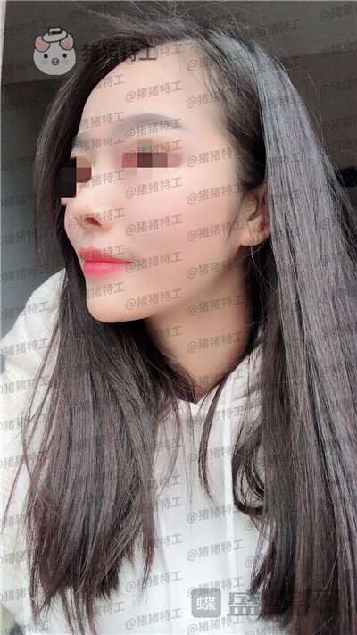 重庆铂生,杜亚旭,,案例,价格,