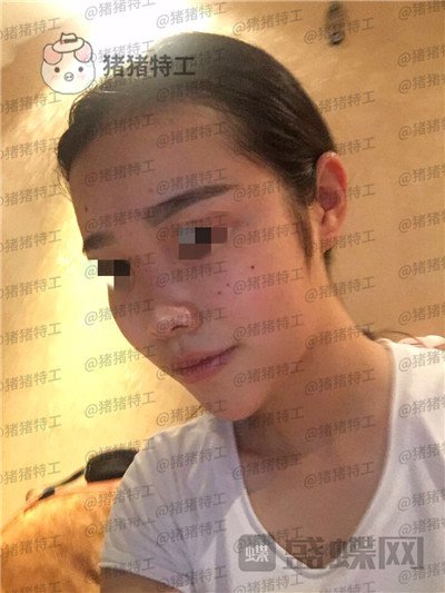 重庆铂生,杜亚旭,,案例,价格,