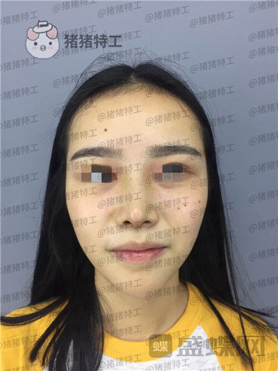 重庆铂生,杜亚旭,,案例,价格,