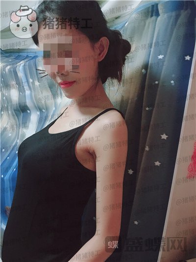 北京美莱董岩岩隆胸案例价格分享，飞机场竟然也能做成这个果！