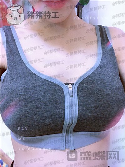 北京美莱董岩岩隆胸案例价格分享,飞机场竟然也能做成这个果!