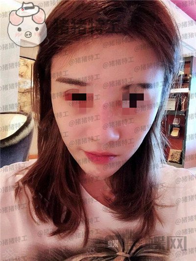 上海艺星,李建兵,隆鼻,案例,价格,